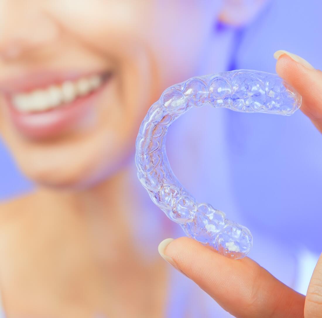 Clean aligners Norwich